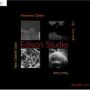 DVD Edison Studio - Cemat